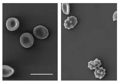 Red blood cells are pictured in grayscale on a gray background Red blood cells are pictured in grayscale on a gray background